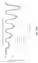 Fig. 07 - Ultrasonic testing using a phased array