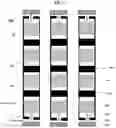Fig. 04 - Antenna module and display device including the same