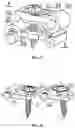 Fig. 16 - Bone fixation system capable of gradually changing from rigid fixation to axial non-rigid fixation