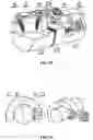 Fig. 17 - Bone fixation system capable of gradually changing from rigid fixation to axial non-rigid fixation