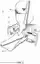 Fig. 03 - Robotized system for femoroacetabular impingement resurfacing