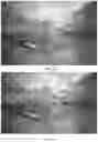Fig. 09 - Displaying Suture Force Information in Surgery