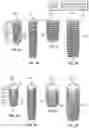 Fig. 02 - DENTAL IMPLANT HAVING TAPERED THREADED SURFACE WITH INSTALLATION ENHANCEMENT FEATURES
