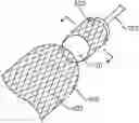 Fig. 01 - IMPLANT DELIVERY DEVICES AND METHODS OF MAKING THE SAME
