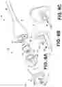 Fig. 10 - Tether assemblies for medical device delivery systems
