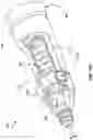 Fig. 29 - Tether assemblies for medical device delivery systems