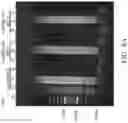 Fig. 13 - Nucleic acid detection kit and nucleic acid detection method