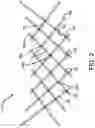 Fig. 03 - Expandable fire fence with additional safety features