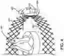 Fig. 05 - Expandable fire fence with additional safety features
