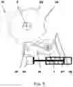 Fig. 04 - Module for a system for synchronizing and driving a transmission gearbox countershaft