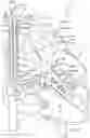Fig. 12 - Arrangement for Transporting a Liquid Through a Cannula System, Corresponding Kit and Method