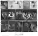 Fig. 11 - ORGANOID MESODERM LINEAGE DIVERSIFICATION