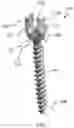 Fig. 02 - MULTI-FEATURE POLYAXIAL SCREW