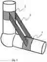 Fig. 02 - ORTHOTIC
