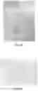 Fig. 04 - APPLICATION AID FOR OSTOMY DEVICE