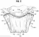 Fig. 03 - CRUSHED PIECES COLLECTOR