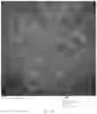 Fig. 09 - Chimeric papilloma virus L1 protein