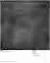 Fig. 11 - Chimeric papilloma virus L1 protein
