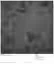 Fig. 13 - Chimeric papilloma virus L1 protein