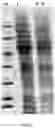 Fig. 20 - Chimeric papilloma virus L1 protein