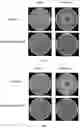 Fig. 07 - Bacteria repellant polymer composites
