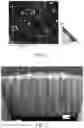 Fig. 02 - Nano-twinned copper layer with doped metal element, substrate comprising the same and method for preparing the same