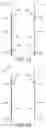 Fig. 11 - Grain Dryer Output Capacitive Moisture Sensing Assembly And Related Methods