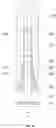 Fig. 72 - Caseless magazine weapon (variants)