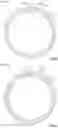 Fig. 05 - Inductive angle sensor