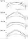 Fig. 02 - POLARIZED LENS FOR SPECTACLES, METHOD FOR MANUFACTURING POLARIZED LENS FOR SPECTACLES, METHOD FOR MANUFACTURING FRAMED SPECTACLE, AND METHOD FOR INSPECTING POLARIZED LENS FOR SPECTACLES