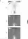 Fig. 06 - Tone management using tone gain functions for high dynamic range imaging applications