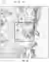 Fig. 22 - Image analysis in pathology