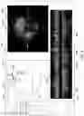 Fig. 09 - Systems and methods for vascular image co-registration