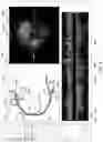 Fig. 10 - Systems and methods for vascular image co-registration