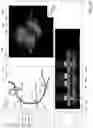 Fig. 12 - Systems and methods for vascular image co-registration