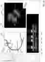 Fig. 16 - Systems and methods for vascular image co-registration