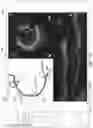 Fig. 19 - Systems and methods for vascular image co-registration