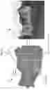 Fig. 33 - IMAGE ANALYSIS