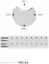 Fig. 11 - SYSTEMS AND METHODS FOR MEDICAL IMAGING