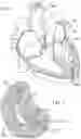 Fig. 02 - HEART VALVE DOCKING COILS AND SYSTEMS
