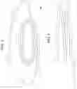 Fig. 03 - HEART VALVE DOCKING COILS AND SYSTEMS