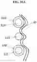 Fig. 13 - HEART VALVE DOCKING COILS AND SYSTEMS