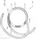 Fig. 18 - HEART VALVE DOCKING COILS AND SYSTEMS