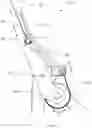 Fig. 08 - MEDIAL UNILATERAL EXOSKELETON