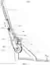 Fig. 09 - MEDIAL UNILATERAL EXOSKELETON