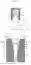 Fig. 02 - DAMPING INSULATOR FOR FUEL INJECTION DEVICE