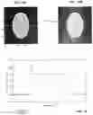 Fig. 09 - Computed tomography (CT) image reconstruction from polychromatic projection data