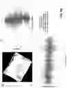 Fig. 08 - Persistent feature based image rotation and candidate region of interest