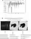 Fig. 01 - METHOD AND SYSTEMS FOR THE AUTOMATED DETECTION OF FREE FLUID USING ARTIFICIAL INTELLIGENCE FOR THE FOCUSED ASSESSMENT SONOGRAPHY FOR TRAUMA (FAST) EXAMINATION FOR TRAUMA CARE