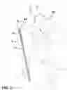 Fig. 03 - Modular walking stick assembly